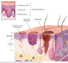 The main source of uv light is sunlight. Skin Cancer Symptoms And Causes Mayo Clinic