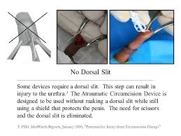 Image result for circumcision shield