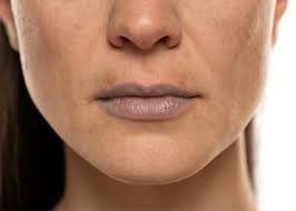 Dark Lips Treatment in Delhi - Influennz Clinic