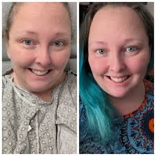 Following Sherri Lynn with a similar post I had/ have lots of serious  health issues. Severe sleep apnea High BP Diabetes type 2 Coeliac disease  Fibromyalgia M.E. Severe degenerative athritis in back