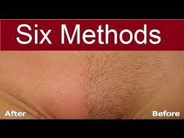 There are plenty of ways to effectively remove pubic hair from your private parts. How I Removed My Armpit Hair Permanently Body Hair Removal Youtube Hair Removal Diy Body Hair Removal Best Hair Removal Products