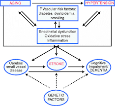 Image result for Stroke Pathophysiology