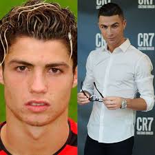 Cristiano ronaldo's highlights and achievements in the 2018/2019 season. Confira Um Antes E Depois De Cristiano Ronaldo E Outros Jogadores De Futebol Estrelando