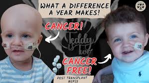 TEDDY'S HICKMAN LINE HAS BURST!!! POST AML LEUKAEMIA AND BONE MARROW  TRANSPLANT! #EP23