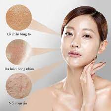 Da dầu là da như thế nào ?