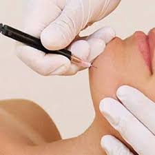 Like laser hair removal, electrolysis also takes multiple treatments to destroy the root of the hair. Electrolysis Laser Hair Removal In Dubai Abu Dhabi Cost Price