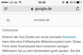Repturierte Ovarialzyste Entdeckt Und Geplatzt Trotzdem Hoffen Das Eine Ss Entstanden Ist Urbia De