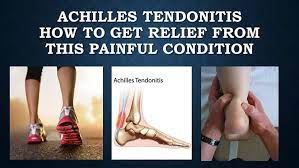 How To Treat Achilles Tendonitis Using The Rice Method Many Treatments Are Available For Achilles Tendonitis Rang Achilles Tendonitis Tendinitis Chronic Stress