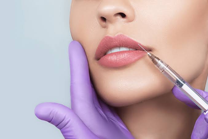 Juvederm Fillers Before & After| The Cosmetic Skin Clinic