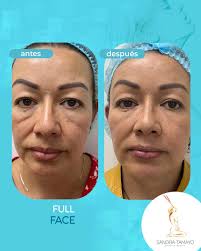 Sandra Tamayo Estética Médica