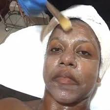 Gorgeous go-to: Sinnamon Skin Klinik and Rejuvenation Centre pt. 2!