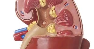 Remove Your Stone Forever Just In Three Days Anywhere Stone In Your Body Just Like Gallbladder And Kidney Or Urater No In 2020 Ayurvedic Medicine How To Remove Kidney