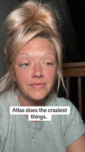 Unexpected Dog Attack Caught