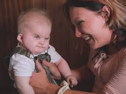 Marshfield boy with no thymus lives in 'bubble,' awaits transplant