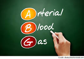 Tic Tac Toe Method Arterial Blood Gas Abg Interpretation