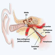 Inferior, middle and superior nasal conchae (turbinates) superiorly: Eustachian Tube Dysfunction Mcgovern Medical School