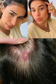 She took us the hospital it was done and this happend