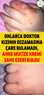 Onlarca Doktor Kizinin Egzamasina Care Bulamadi Anne Careyi Market Rafinda Sans Eseri Buldu Workout Meal Plan Back Weight Exercises Health Fitness