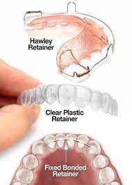 Dental Retainers Hawley Retainer Clear Plastic Retainer And Fixed Bonded Reta Bonded Clear Dental Fixed Hawley P Dental Retainer Orthodontics Dental