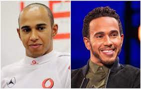 It is unacceptable, cowardly and misguiding for those in power to suggest such a law. vettel said: Lewis Hamilton Haartransplantation Geruchte Wahr Oder Falsch