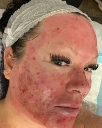 ✨Jaime Gilson✨ (@all.things.esthetics.by.jaime) • Instagram photos and  videos