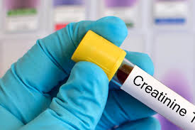 La créatinine est produite en quantité constante dans l'organisme, et provient du métabolisme musculaire. Creatinine Creatininemie Interpreter Ses Resultats