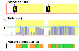 1,000+ vectors, stock photos & psd files. Cpr Feedback Starkt Kompressionsqualitat Jdmt Medical Services