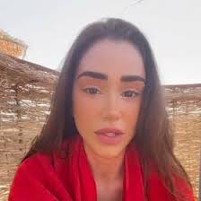 Veronica Biasiol šla s kůží na trh: V emotivním videu přiznala, že má  vitiligo