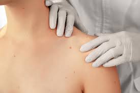 Bahkan senyawa yang dapat berperan sebagai obat juga bisa. Bikin Ganggu Ini Cara Menghilangkan Jerawat Di Badan