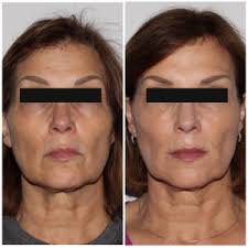 White Coat Aesthetics