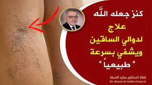 علاج دوالى ااساقين دكتور مازن السقا. ÙƒÙ†Ø² Ø¬Ø¹Ù„Ù‡ Ø§Ù„Ù„Ù‡ Ø¹Ù„Ø§Ø¬ Ø¯ÙˆØ§Ù„ÙŠ Ø§Ù„Ø³Ø§Ù‚ÙŠÙ† ÙˆÙŠØ´ÙÙŠ Ø¨Ø³Ø±Ø¹Ø© Ø·Ø±Ù‚ Ø·Ø¨ÙŠØ¹ÙŠØ© Ù„Ù…Ø­Ø§Ø±Ø¨Ø© Ø§Ù„Ø£ÙˆØ±Ø¯Ø© Ø§Ù„Ø¹Ù†ÙƒØ¨ÙˆØªÙŠØ© ÙˆØ¯ÙˆØ§Ù„ÙŠ Ø§Ù„Ø³Ø§Ù‚ÙŠÙ† Youtube