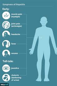 Image result for hepatitis symptoms