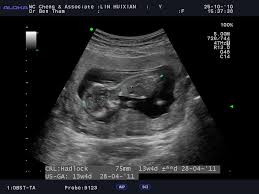 Lovingyoualways Baby Growing Up Pic In Mommy S Tummy