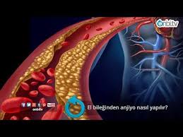 El Bileginden Anjiyo Nasil Yapilir Youtube