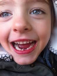 MAX-IV visit report: a forward-looking storage ring