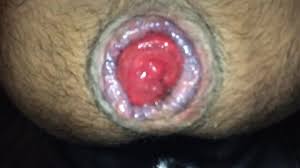 Prolapse Licking: Gay Porn