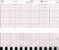 Graphic Controls Recording Paper Chart Fetal Ge Cms 4305 Box Of 40 Model 7g30597226