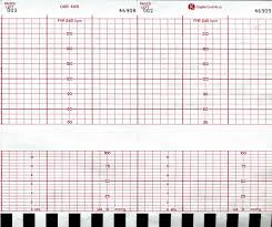 graphic controls recording paper chart fetal ge cms 4305 box of 40 model 7g30597226