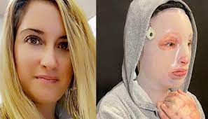 Μορφή χιονοστιβάδας παίρνουν οι αποκαλύψεις για την επίθεση με βιτριόλι κατά της ιωάννας. Ztc8bykzv7clfm