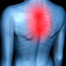 The accessory ligaments for shoulder are coracohumeral ligament, coracoacromial ligament, glenohumeral ligament, and transverse humeral ligament and they are part of the rotator interval, which a space between the subscapularis tendon and the supraspinatus tendon. 6 Most Common Causes Of Middle Back Pain