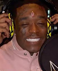 Diamanter er en ettertraktet, og vakker naturskatt. Rapper Has 24m Diamond Implanted In Forehead Thecount Com