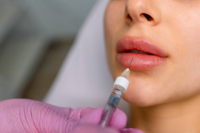 Lip Fillers in Scottsdale, AZ | Beautify Spa