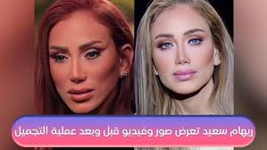 ‫ريهام_سعيد تعرض صور وفيديو قبل وبعد عملية التجميل.. أنا اتشوهت وهاخد حقي  وبقوة عشان حقي ده سمعتي - YouTube‬‎