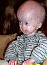 Zachary Kale Moore (2002-2006)