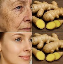 Ginger removes deep wrinkles and dark spots