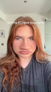 #bugeyes i dont :(