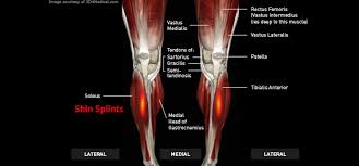 Shin splints can be so extremely painful that you may have to use crutches if you want to go for a walk around the town; Shin Splints Thermoskin Supports And Braces For Injury And Pain Management