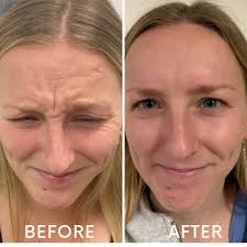 Douglas Helm (@helm_plastics) • Instagram photos and videos