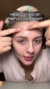 Cystic Acne Fix Overnight