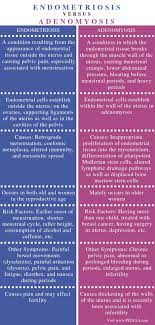 Adenomyosis and endometriosis are both due to the presence of endometrial tissue in sites other than the normal uterine cavity. What Is The Difference Between Endometriosis And Adenomyosis Pediaa Com